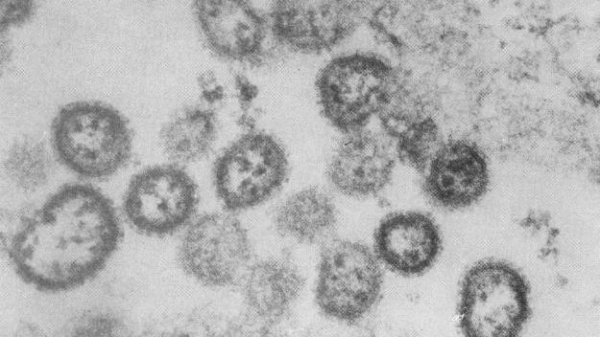 세계보건기구(WHO)가 공개한 아프리카 시에라리온에서 발견된 아레나 바이러스 샘플. (사진=브라질 뉴스포털 UOL/연합뉴스)